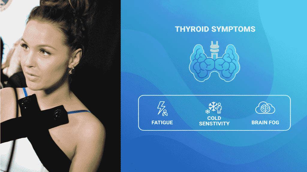 Camilla Luddington with Hashimoto's disease thyroid symptoms infographic